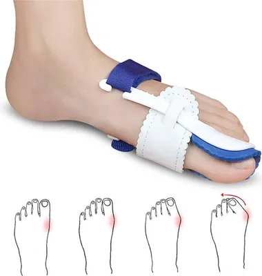 Produktbild von Jumadas – Hallux-Valgus-Schiene – Großzehe – Nachtschiene – Schmerzlinderung – Verbesserung der Zehenposition – Rechter Fuß – Weiß