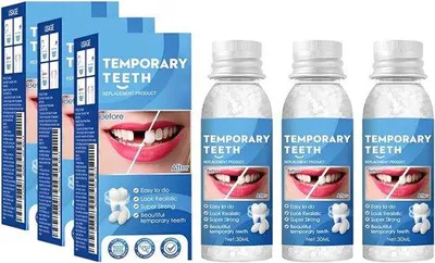Produktbild von 3 formbare Prothesen, 30 g, temporäre Zahnreparatursets, Prothesen zur vorübergehenden Fixierung