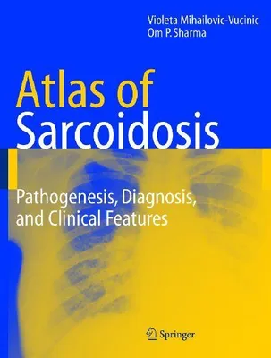 Produktbild von Atlas of Sarcoidosis