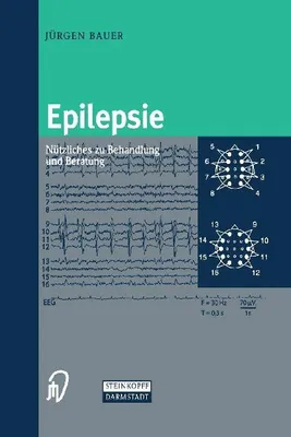 Produktbild von Epilepsie