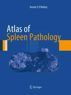 Obrázok produktu pre Atlas of Spleen Pathology