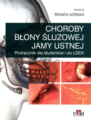 Zdjęcie produktu dla Choroby blony sluzowej jamy ustnej