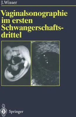Produktbild von Vaginalsonographie im ersten Schwangerschaftsdrittel