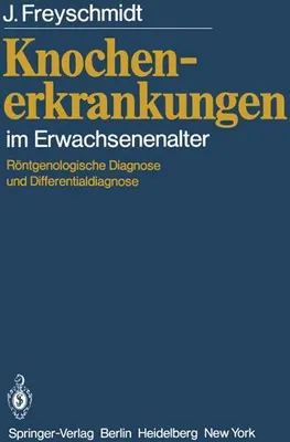 Obrázok produktu pre Knochenerkrankungen im Erwachsenenalter