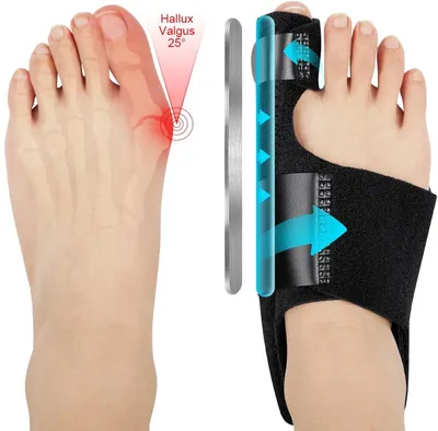 Produktbild von Namajunas® - 2 Hallux Valgus Großzehen-Korrektoren - 2 Zehenspreizer aus Silikon - Verstellbar - Hallux Valgus Schiene.