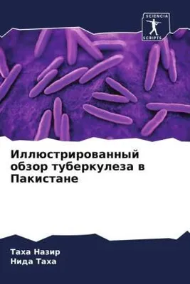 Produktbild von Illüstrirowannyj obzor tuberkuleza w Pakistane
