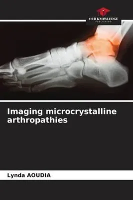 Produktbild von Imaging microcrystalline arthropathies
