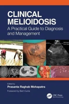Immagine prodotto di Clinical Melioidosis