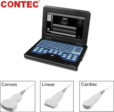 Immagine prodotto di Apparecchio ecografico portatile Apparecchio ecografico portatile B con 3 sonde cardiache lineari convesse