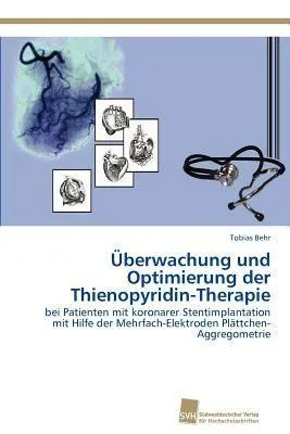 Produktbild von Überwachung und Optimierung der Thienopyridin-Therapie