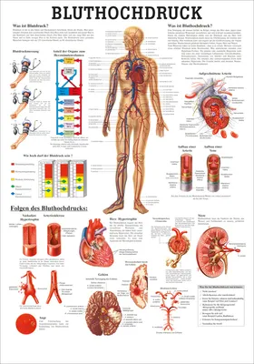 Produktbild von Bluthochdruck Poster Anatomie 70x50 cm medizinische Lehrmittel