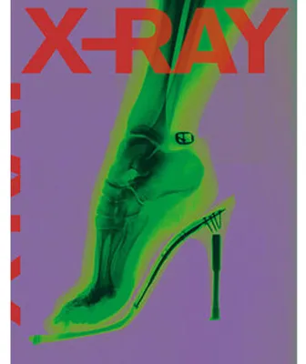 Obrázek produktu pro X-Ray