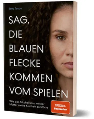 Immagine prodotto di Sag, die blauen Flecke kommen vom Spielen