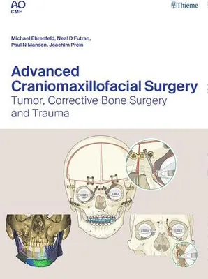 Obrázek produktu pro Advanced Craniomaxillofacial Surgery