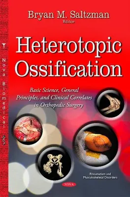 Zdjęcie produktu dla Heterotopic Ossification