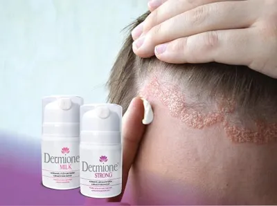 Obrázek produktu pro Dermione® - ŠETRNÁ ENZYMATICKÁ PÉČE O POKOŽKU PŘI PROJEVECH LUPÉNKY