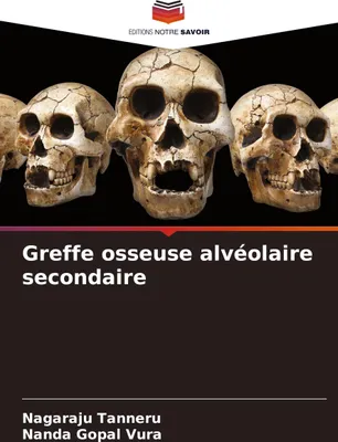 Produktbild von Greffe osseuse alvéolaire secondaire