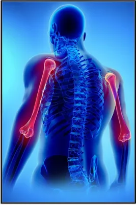 Produktbild von Wallario Wandbild Anatomie Mensch  Oberarmknochen, Größe: 61 x 91,50 cm, Poster mit schwarzem Aluminiumrahmen