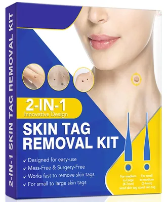 Imagen del producto de Kit para la eliminación de verrugas, juego de herramientas, 1 unidad, para el cuidado de la piel