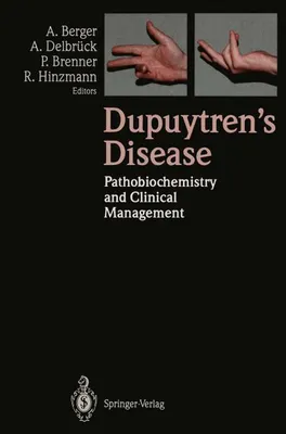 Obrázok produktu pre Dupuytren's Disease