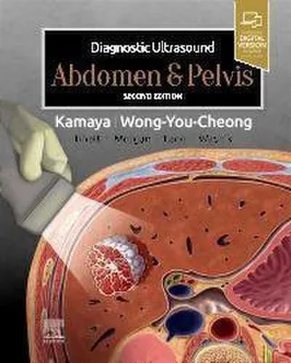 Produktbild von Diagnostic Ultrasound: Abdomen and Pelvis