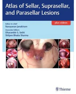 Obrázek produktu pro Atlas of Sellar, Suprasellar and Parasellar Lesions