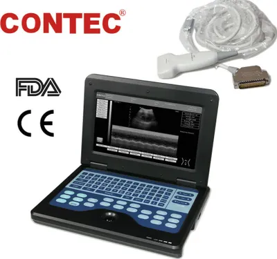 Produktbild von CE 10.1" Tragbares Ultraschall-Scanner-Laptop-Gerät, lineare 7,5-MHz-Sonde Ultraschallgerät
