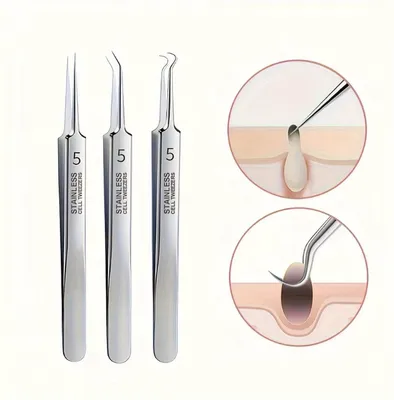 Obrázek produktu pro Sada pro odstraňování černých teček – 3 kusy – 3 pinzety – nerezová ocel – CHPN