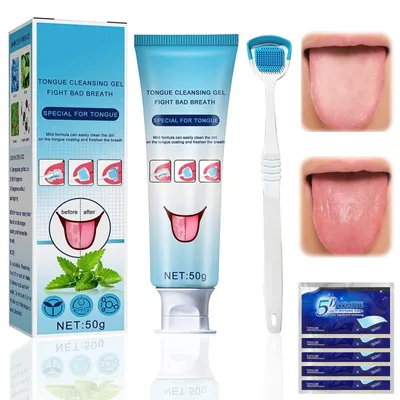 Imagen del producto de Set de limpieza de lengua - Gel limpiador de lengua (50 g) - Cepillo de lengua - Raspador de lengua - Combate el mal aliento - Aliento fresco
