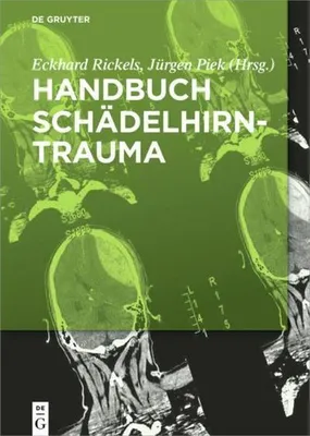 Produktbild von Handbuch Schädelhirntrauma