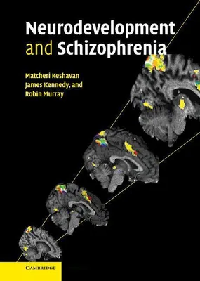 Produktbild von Neurodevelopment and Schizophrenia