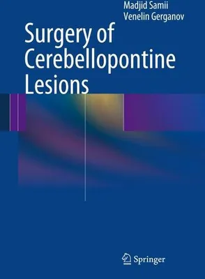 Zdjęcie produktu dla Surgery of Cerebellopontine Lesions