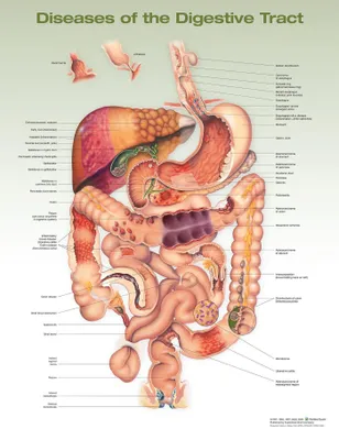 Produktbild von Diseases of the Digestive Tract Anatomical Chart