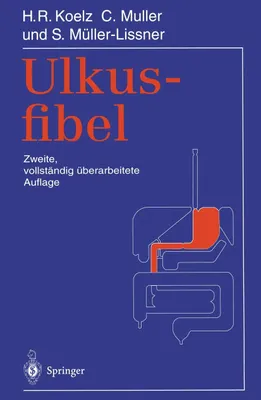 Produktbild von Ulkusfibel