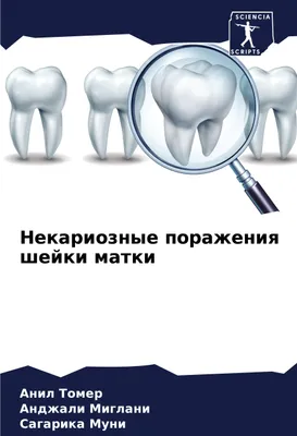 Produktbild von Nekarioznye porazheniq shejki matki