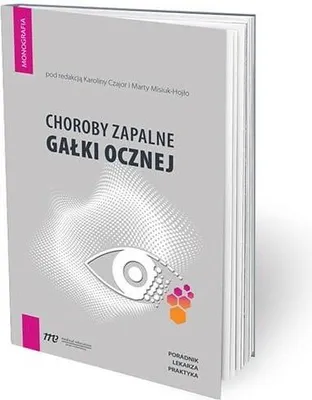 Productafbeelding van Choroby zapalne galki ocznej - poradnik lekarza praktyka