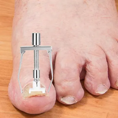 Productafbeelding van Nageltang voor teennagels, robuuste pedicureknipper, ergonomische nagelknipper