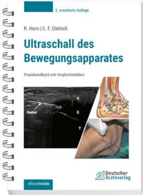 Produktbild von Ultraschall des Bewegungsapparates