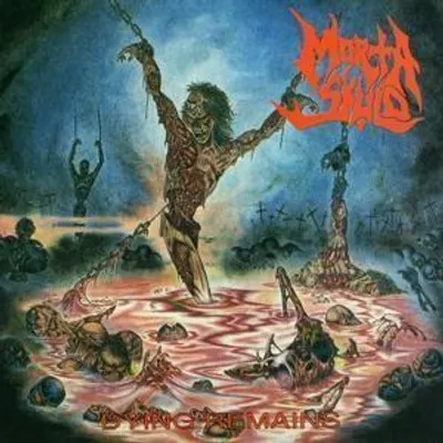 Produktbild von Dying Remains (2CD 30th Anniversary Edition)