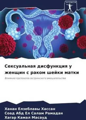 Produktbild von Sexual'naq disfunkciq u zhenschin s rakom shejki matki