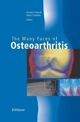 Obrázek produktu pro The Many Faces of Osteoarthritis