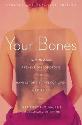 Productafbeelding van Your Bones