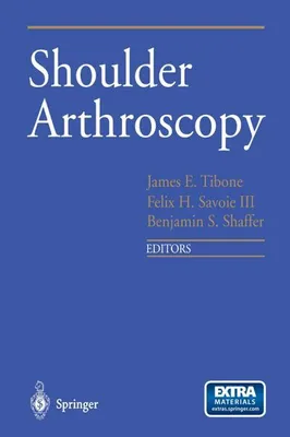 Obrázek produktu pro Shoulder Arthroscopy