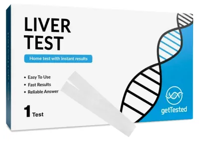 Immagine prodotto di Kit per test a domicilio – Analisi delle urine per la bilirubina e l'urobilinogeno