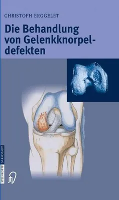 Obrázok produktu pre Die Behandlung von Gelenkknorpeldefekten