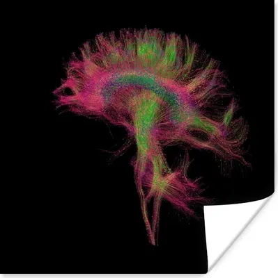 Produktbild von MuchoWow® Poster MRI-Scan 50x50 cm - Wohnzimmerdekoration
