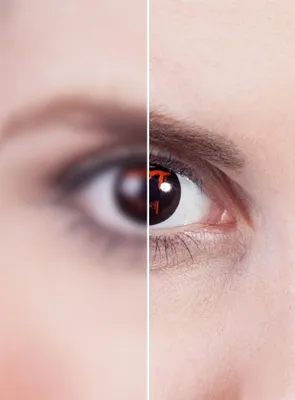 Produktbild von Blut Auge - Halloween Kontaktlinsen mit Dioptrien Dioptrien: -2