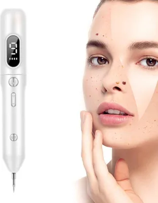 Produktbild von Warzen Entfernen Plasma Pen, Muttermal Entfernen Pigmentflecken Entferner, Schönheitsgerät mit 9 Modi zur Entfernung von Sommersprossen