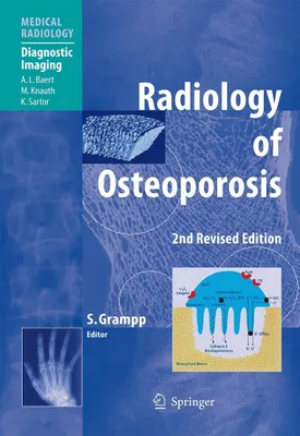 Produktbild von Radiology of Osteoporosis