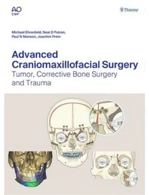 Produktbild von Advanced Craniomaxillofacial Surgery